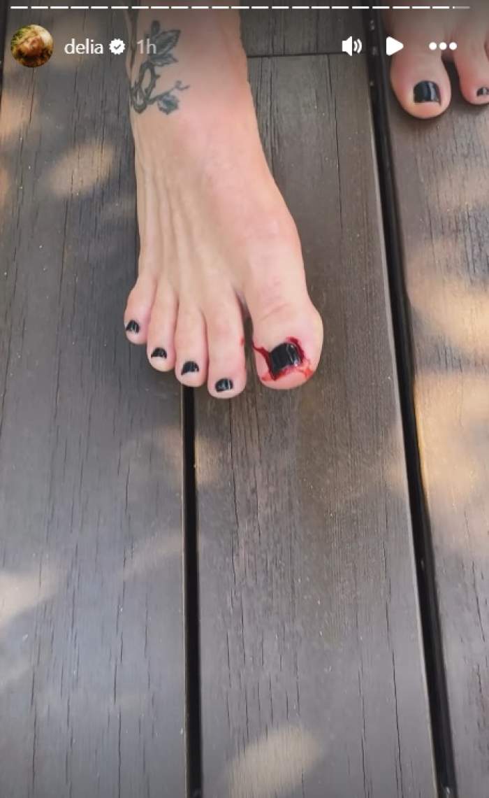 Delia Matache, accident casnic! Cât de rău s-a lovit artista