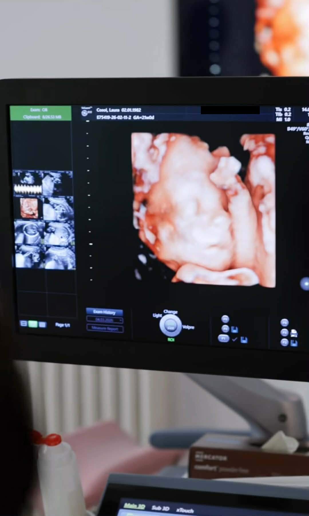 Cum au reacționat fetițele Laurei Cosoi când au aflat ce nume va purta surioara lor! Primele imagini cu bebelușul