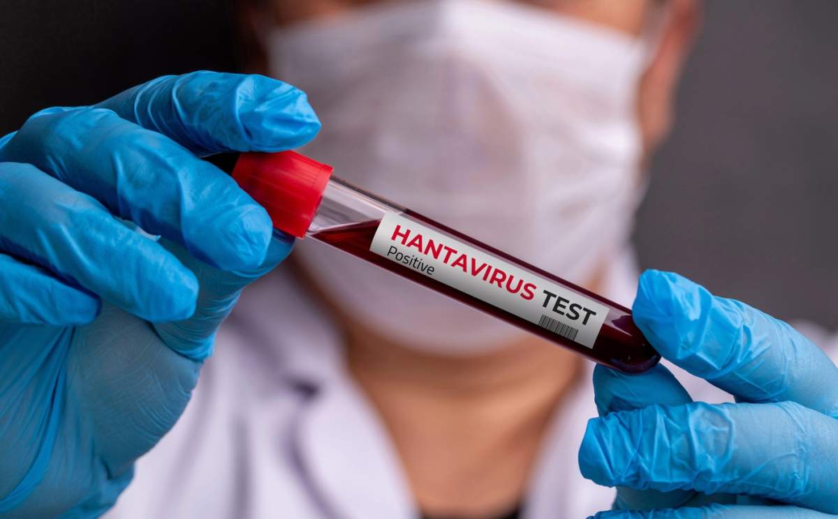 hantavirus