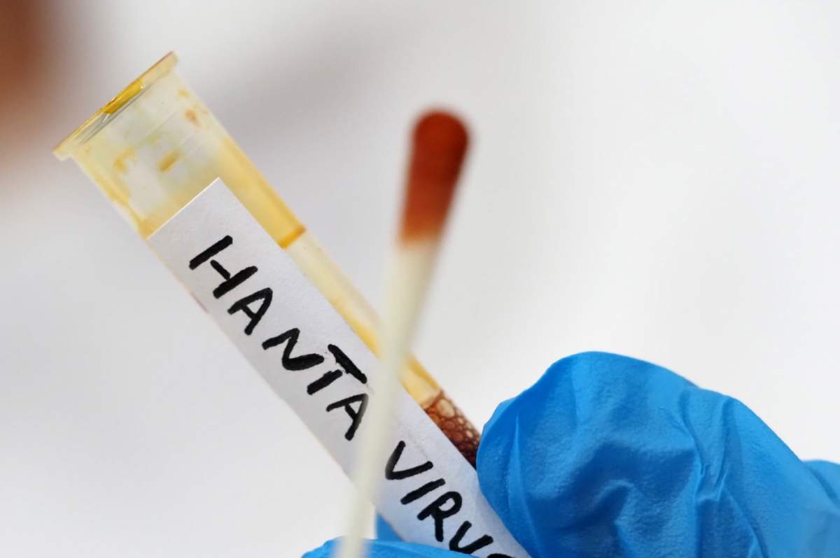 hantavirus