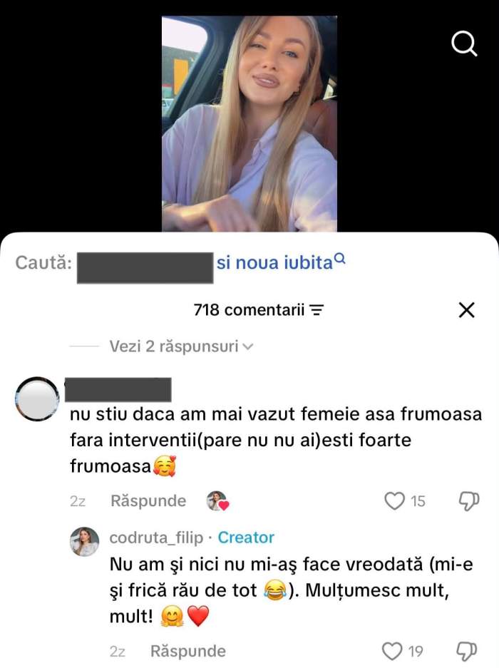 Codruța Filip a spus adevărul despre operațiile estetice. Are sau nu intervenții chirurgicale?