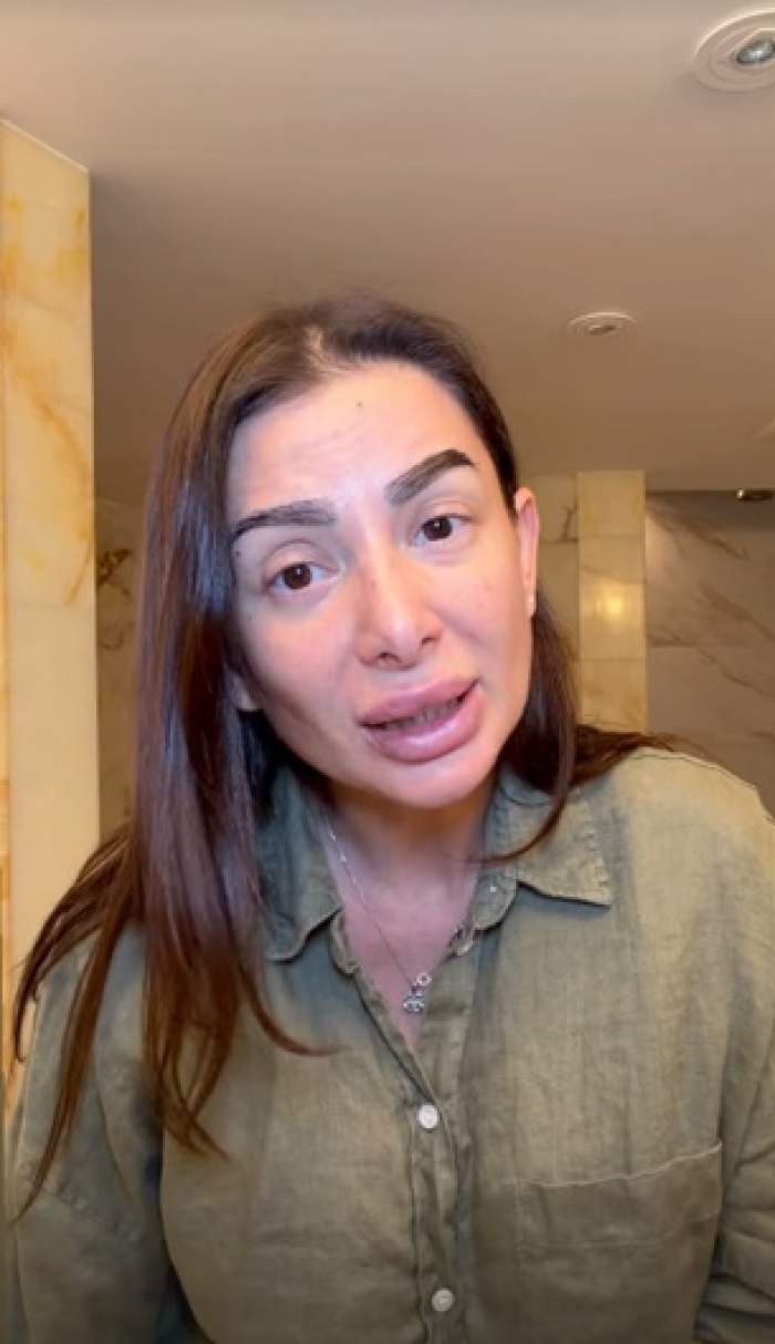Influenceriță din România, mutată în America, anunț șocant: “Mi-a descoperit alunițe cancerigene!”