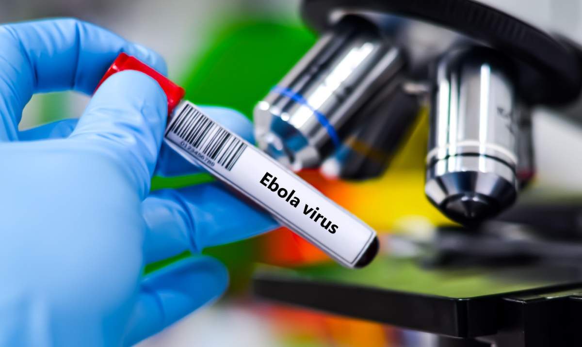 Eprubetă pentru probă de sânge pentru analiza testului pentru virusul Ebola.