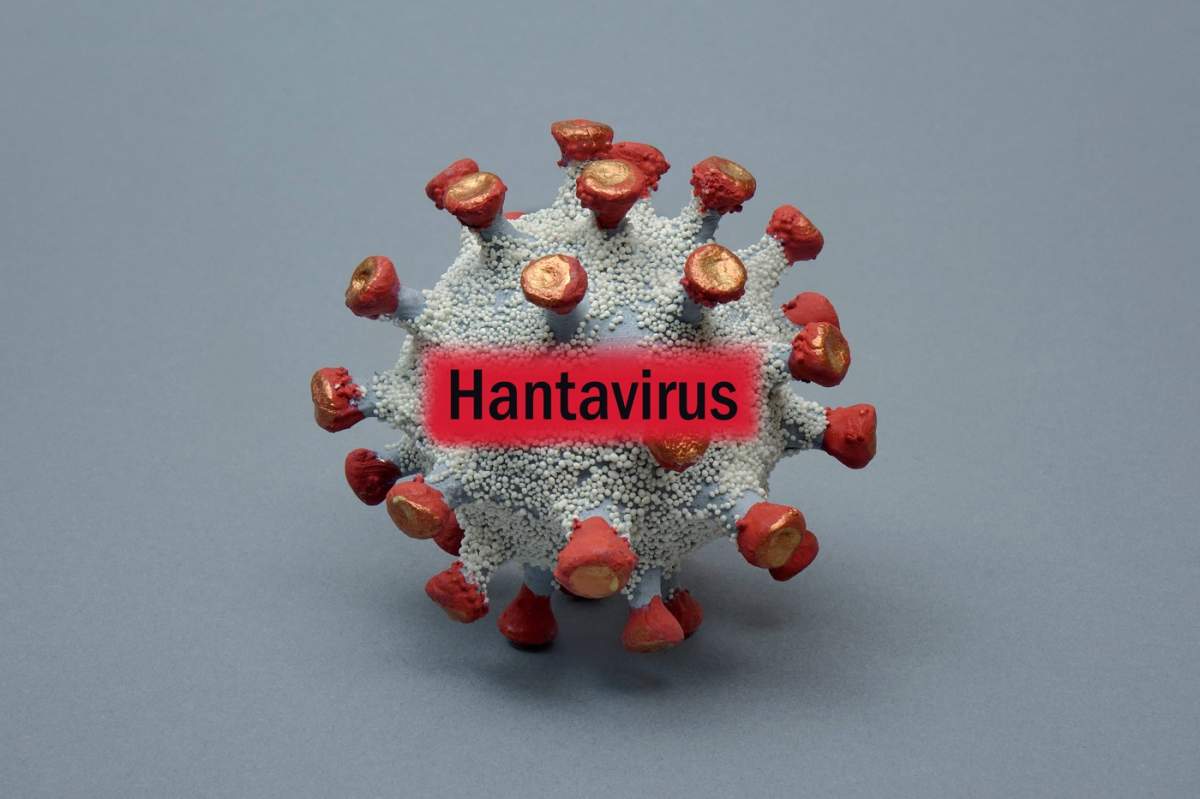 Hantavirus