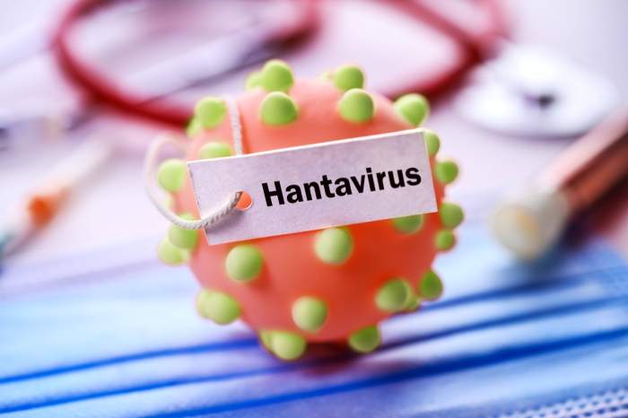 Hantavirus