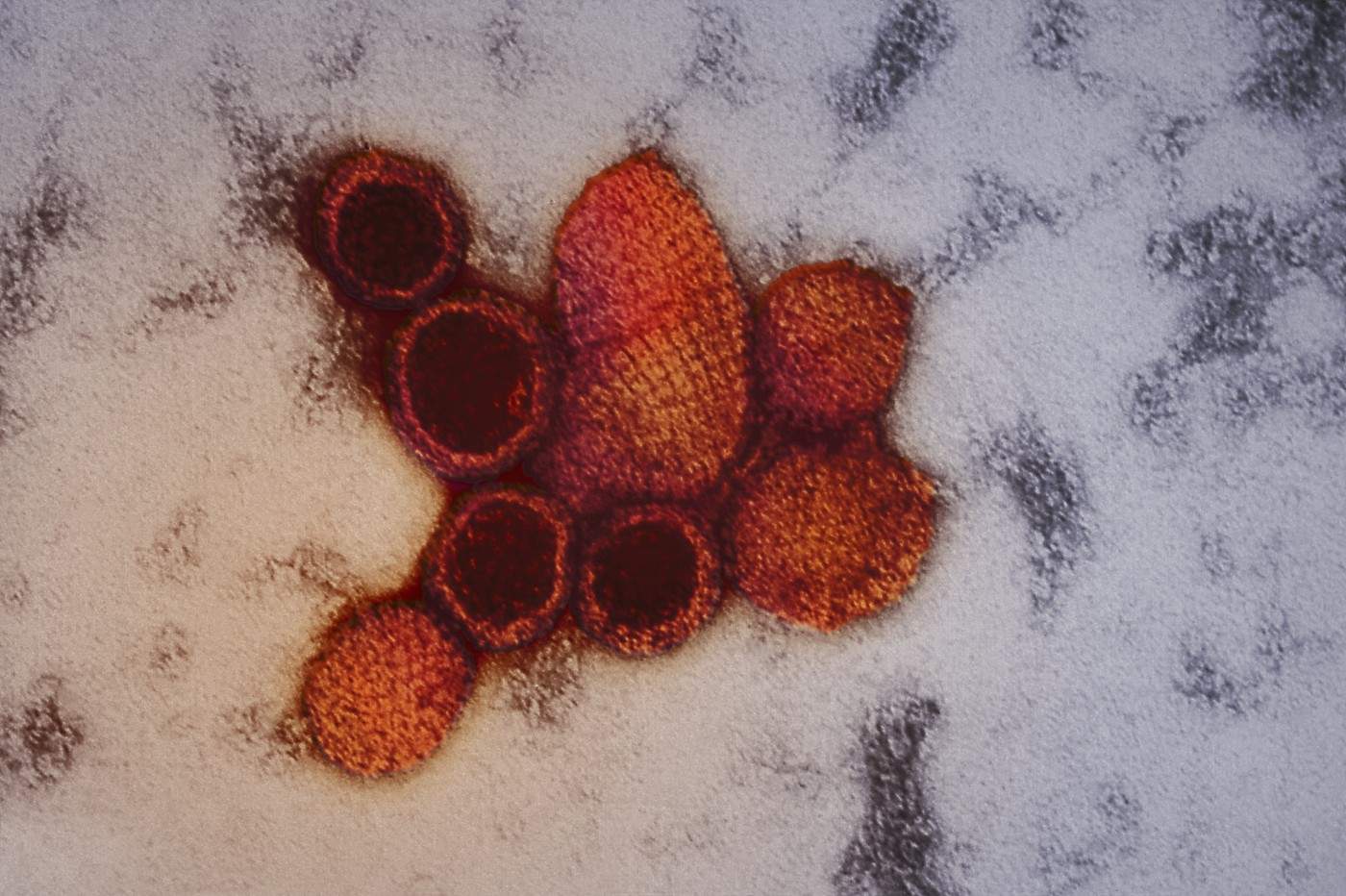 Hantavirus