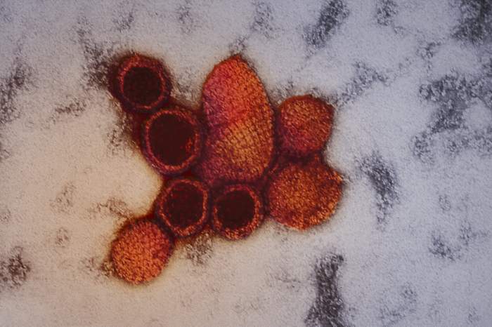 Hantavirus