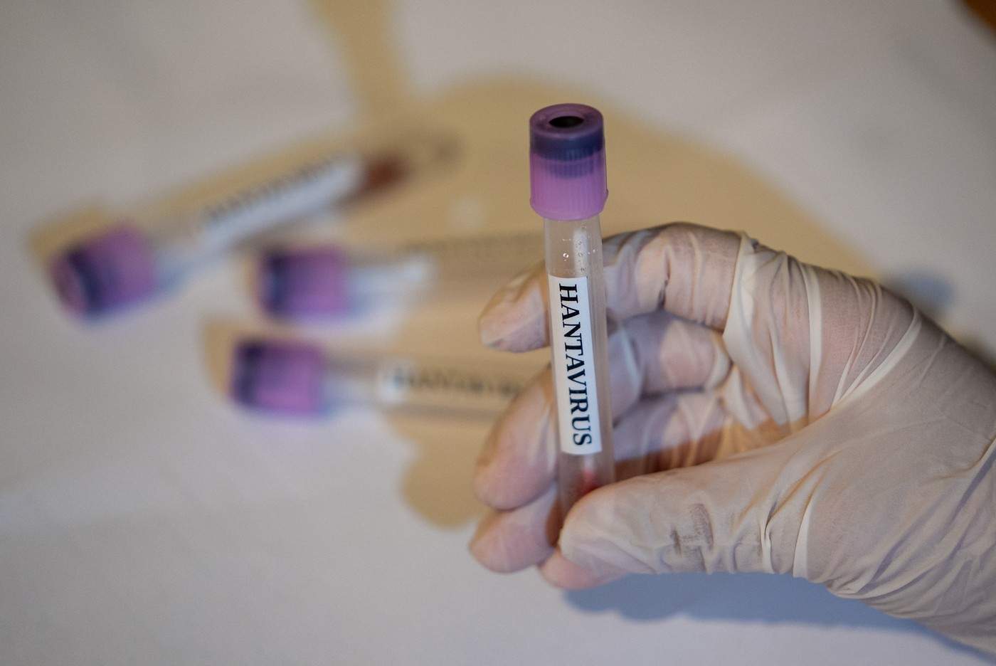 Hantavirus