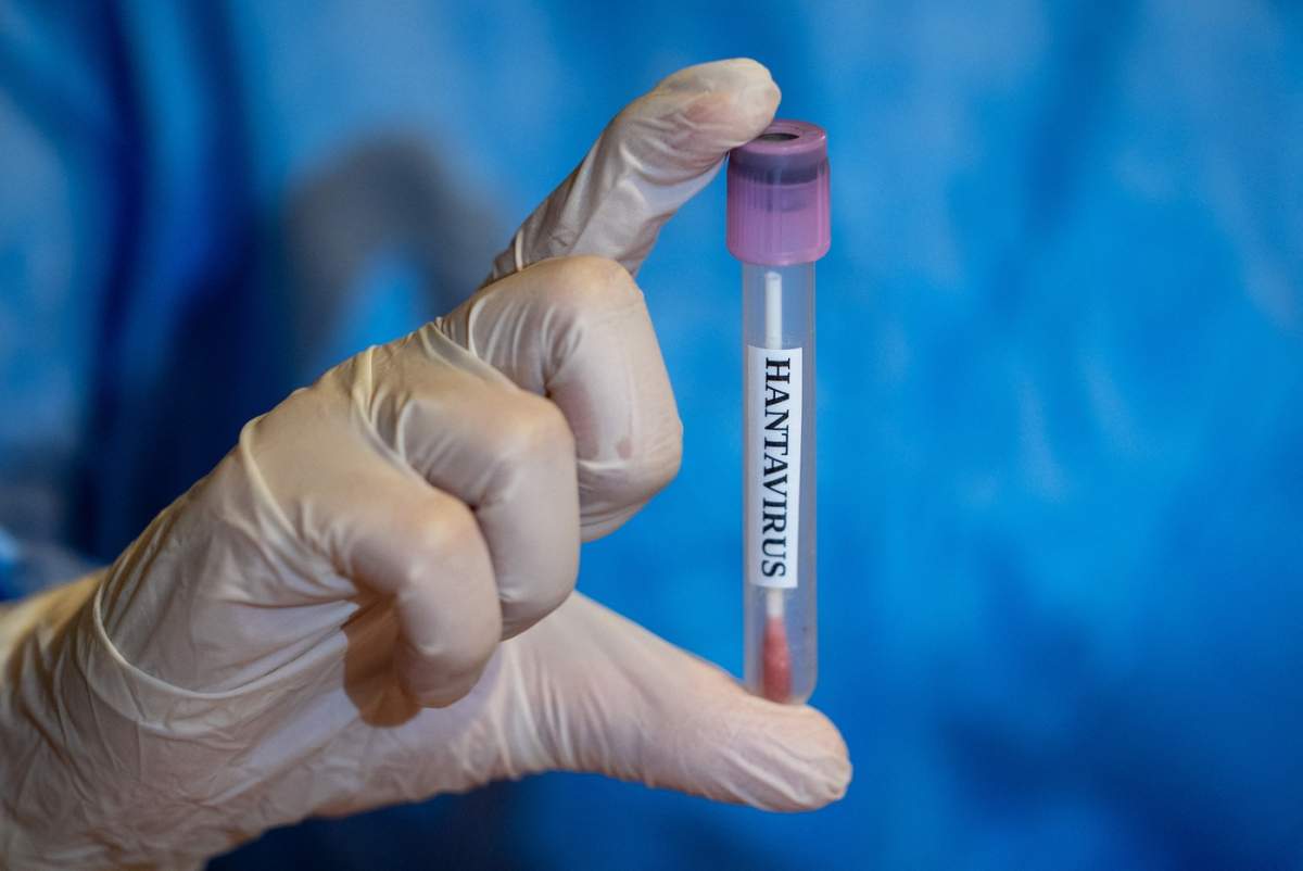 hantavirus