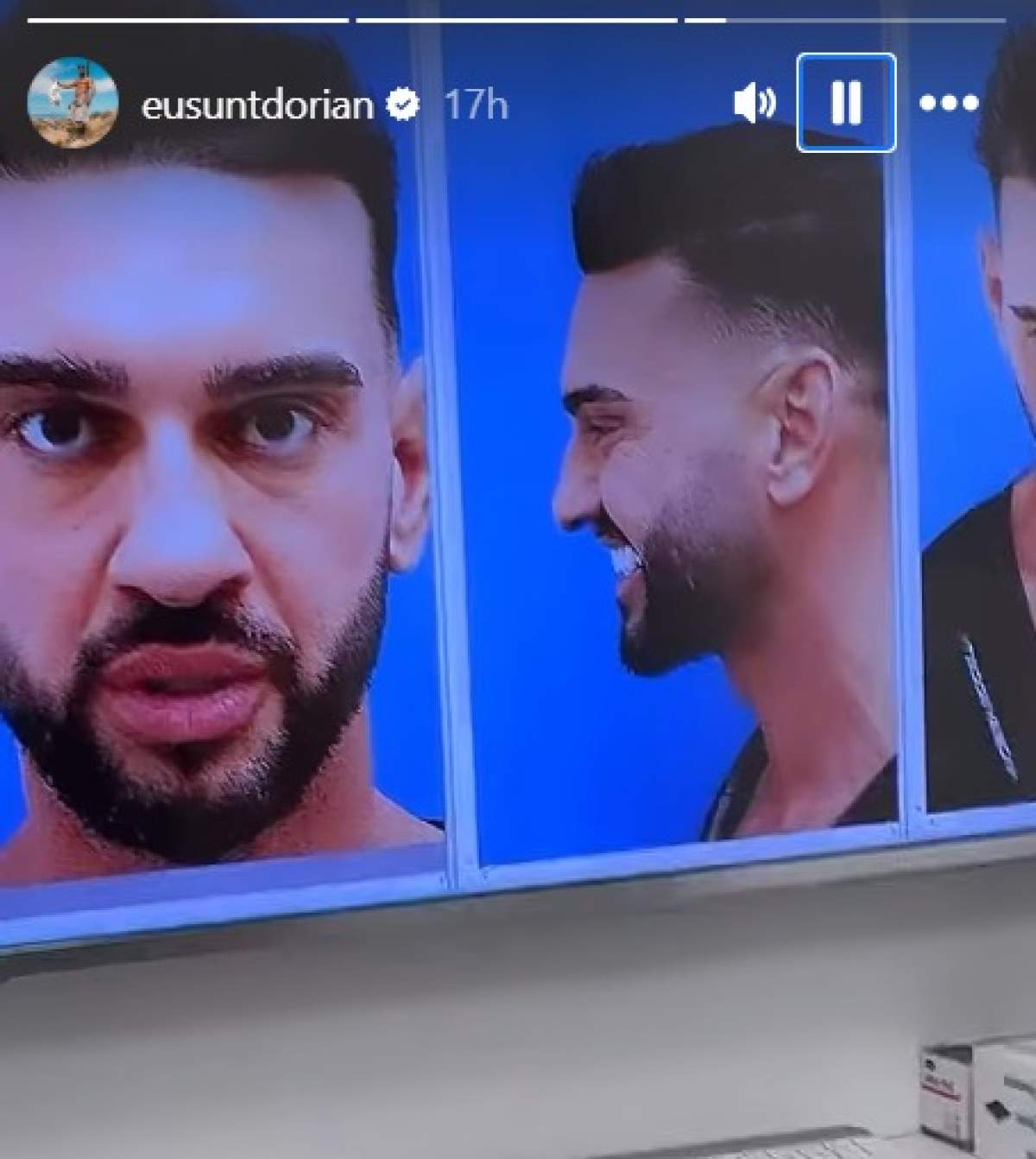 Dorian Popa înainte de operație