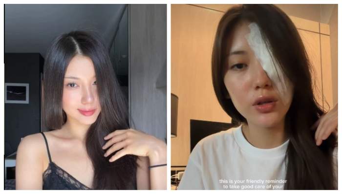 Incident halucinant! O tânără a ajuns aproape să își piardă ochiul. Și tu poți să pățești asta dacă nu ai grijă