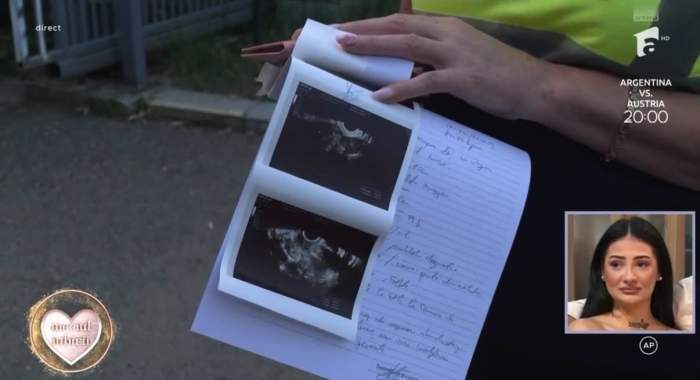 Giulia de la Mireasa a pierdut sarcina! Ce i-au spus medicii. Concurenta a izbucnit în plâns