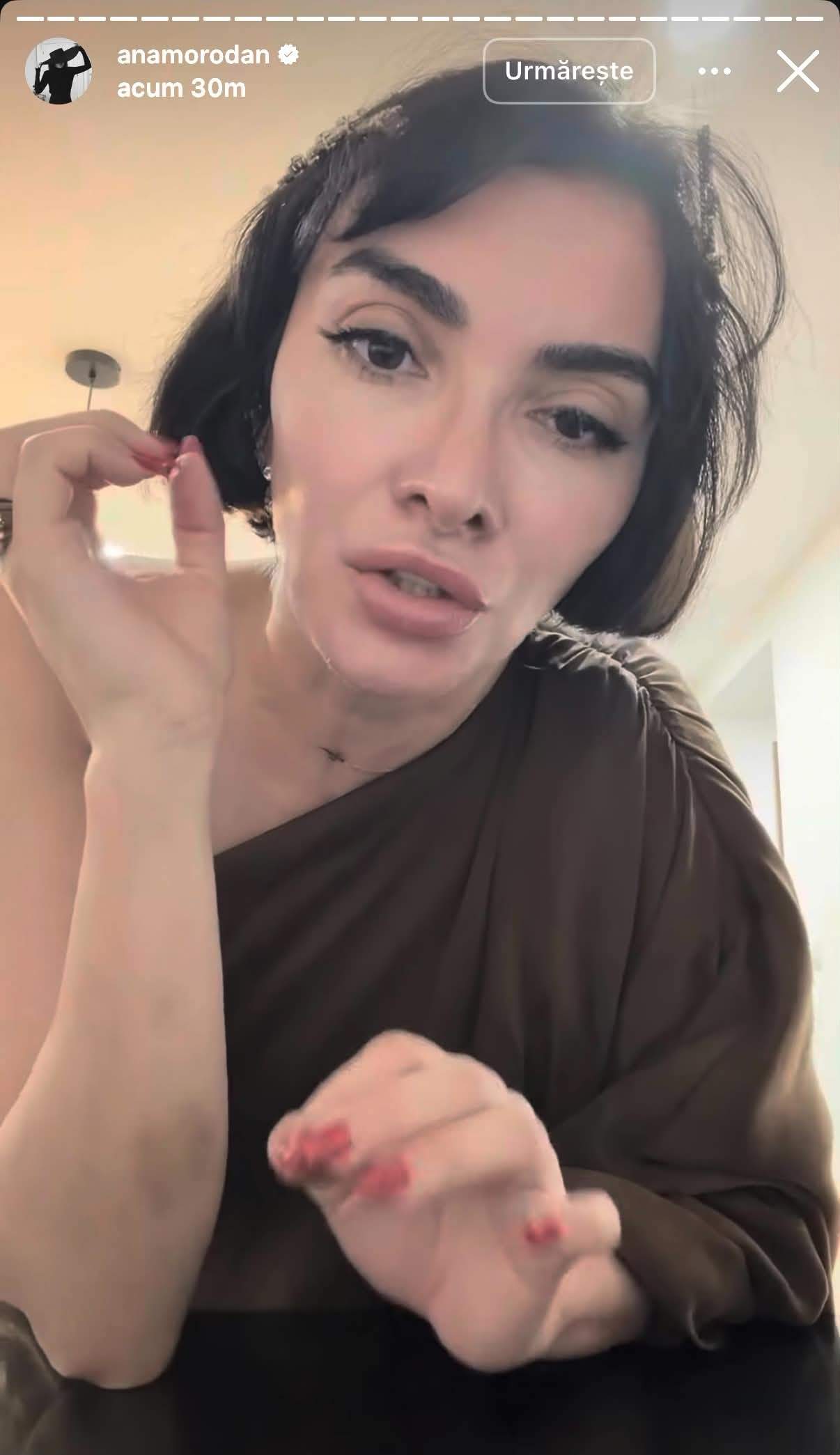 Ana Morodan și-a îngrijorat fanii. Influencerița s-a afișat cu brațele pline de vânătăi