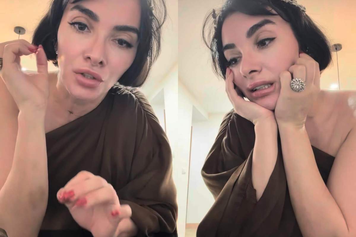 Ana Morodan și-a îngrijorat fanii. Influencerița s-a afișat cu brațele pline de vânătăi