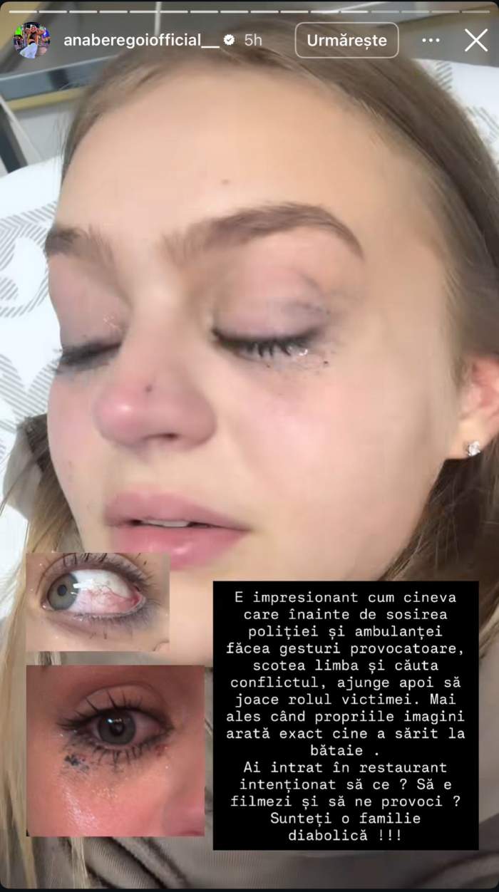 Ana Beregoi, prima reacție după ce s-a încăierat cu Andreea Bostănică! Tânăra susține că a fost legitimă apărare