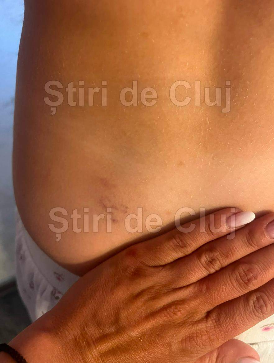 Imagini cu corpul tinerei
