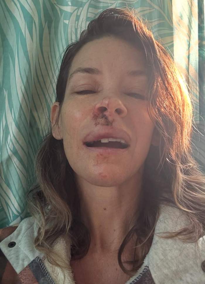 O actriță celebră a suferit un accident teribil! Credea că este o simplă comoție, însă investigațiile au scos la iveală ceva mult mai grav