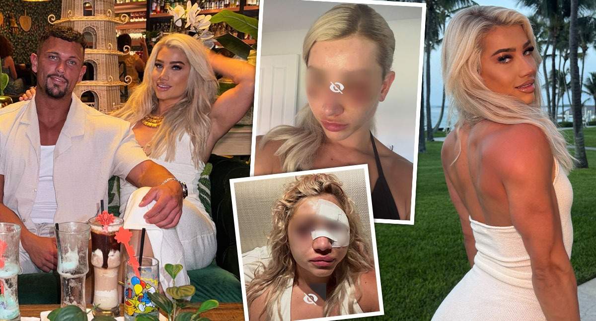 Mărturii și imagini cutremurătoare ale Georgiei! Influencerița a fost bătută de partener în vacanță