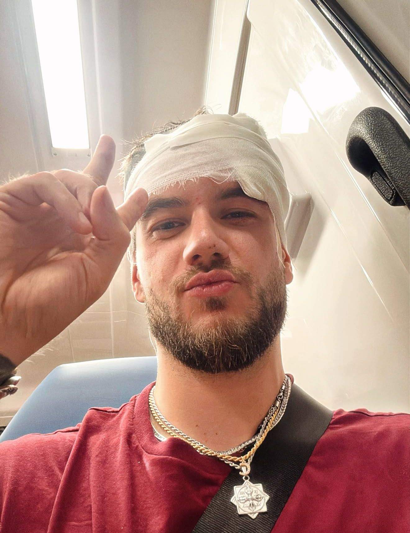 Theo Zeciu, bandajat la cap