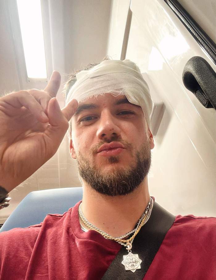 Theo Zeciu, bandajat la cap