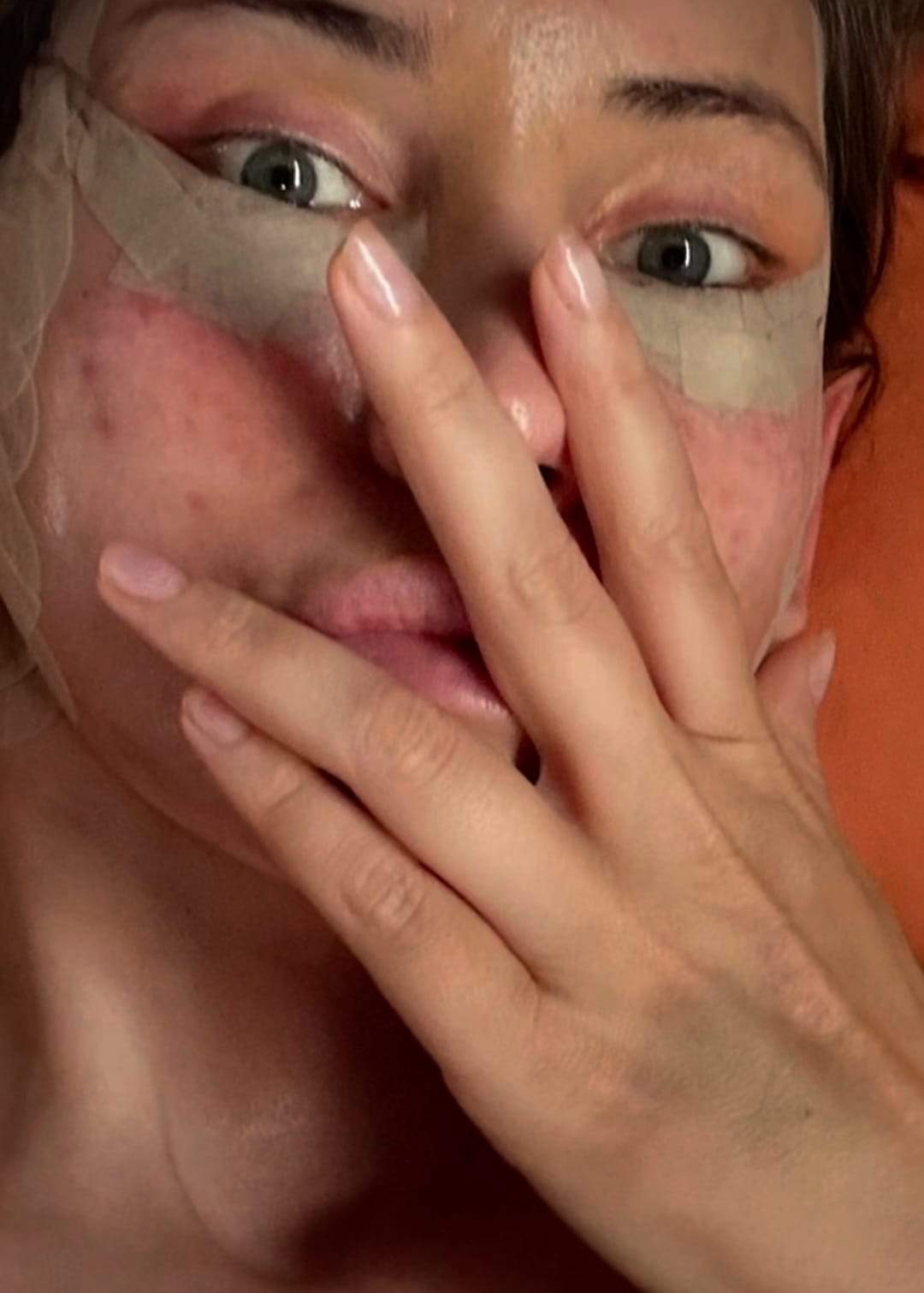 Iulia Albu a dezvăluit de ce a ajuns pe patul de spital. Vedeta s-a afișat cu fața învinețită | FOTO