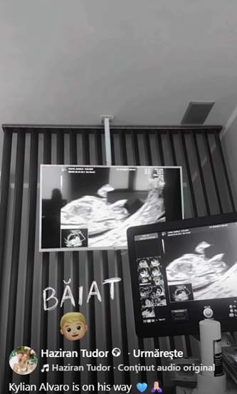 Moment emoționant pentru Haziran și Luis Gabriel. Au aflat dacă vor avea băiețel sau fetiță. Ce nume va purta bebelușul