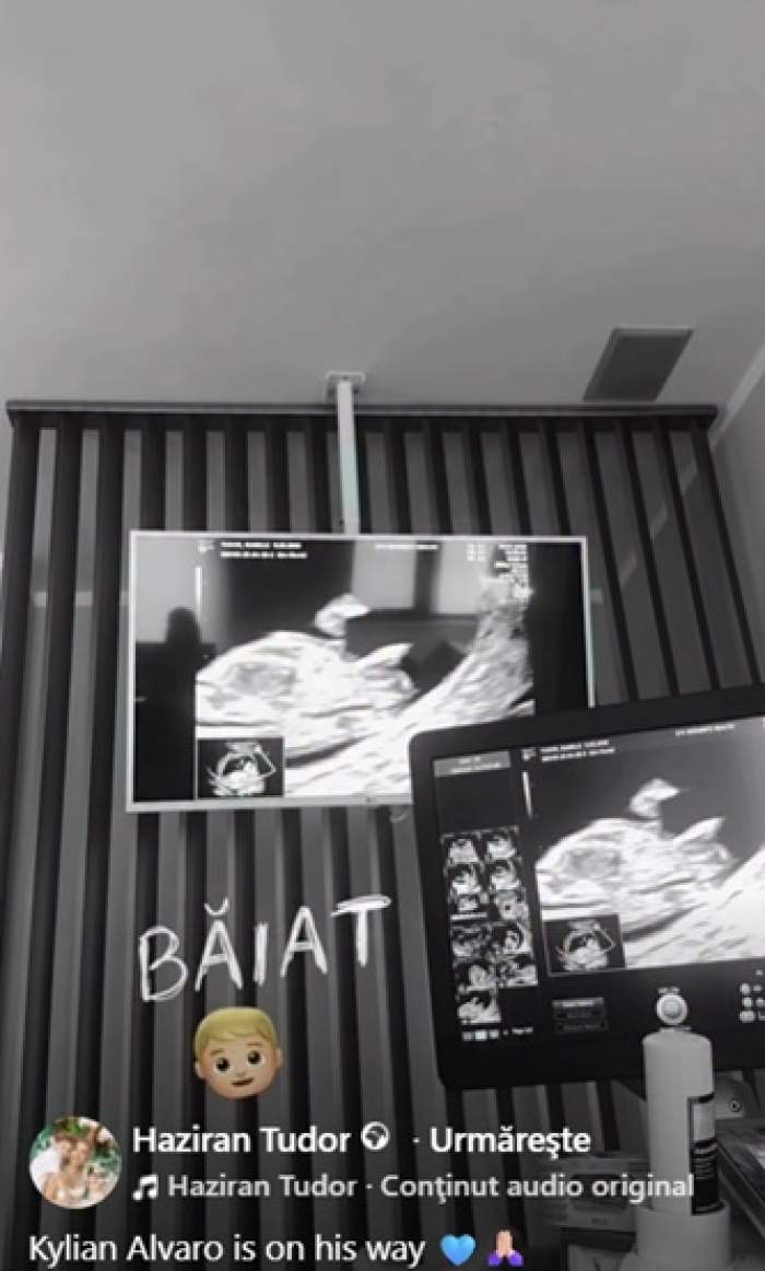 Moment emoționant pentru Haziran și Luis Gabriel. Au aflat dacă vor avea băiețel sau fetiță. Ce nume va purta bebelușul