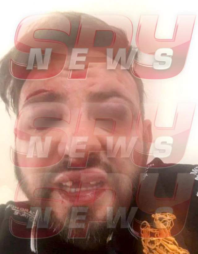 Interlopul care s-a pozat în pat cu Otilia Bilionera, devastat | Legătura cu Mario Iorgulescu