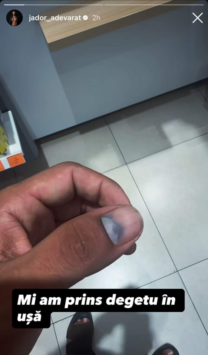 Jador a suferit un accident! Primele declarații ale manelistului