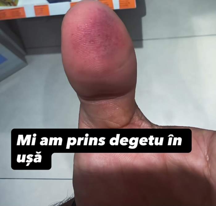 Degetul lui Jador
