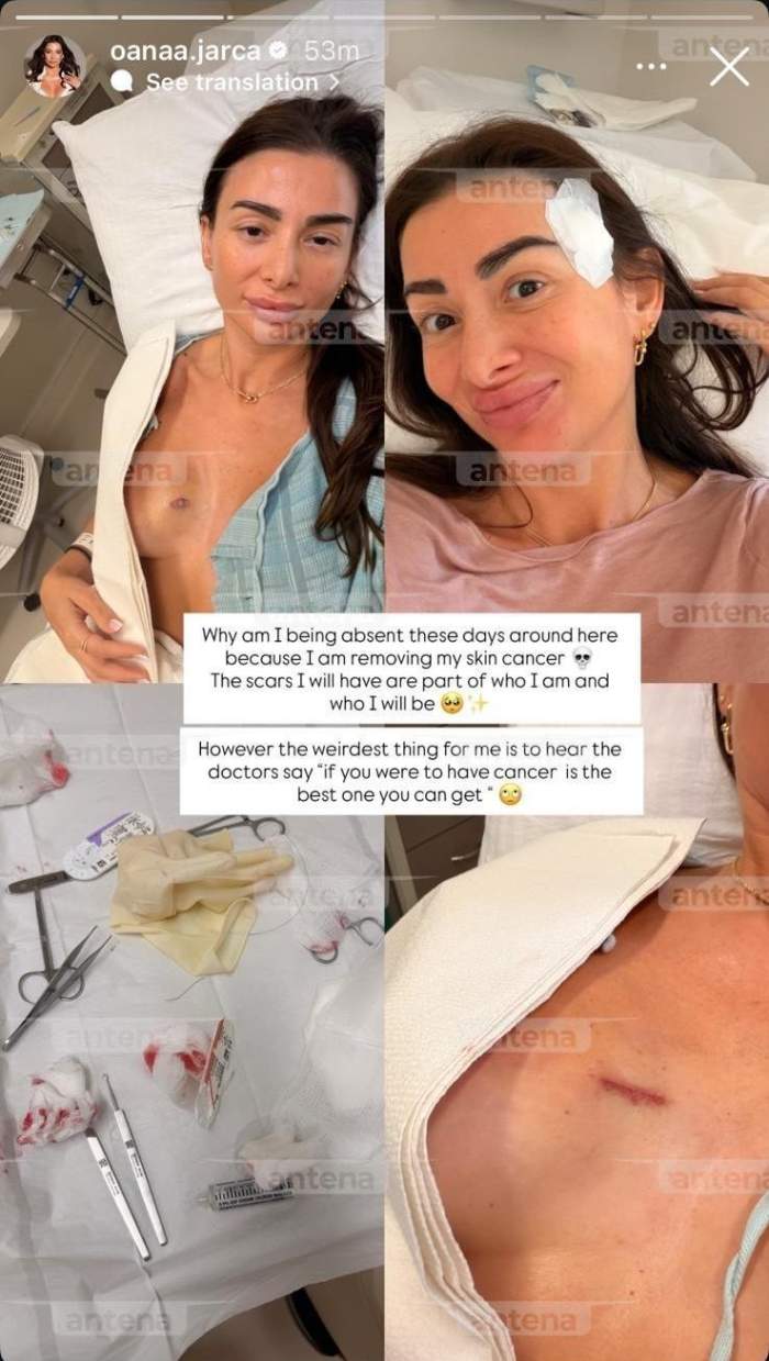 O fostă jurnalistă Antena Stars a primit un diagnostic dur în SUA. A ajuns pe mâna chirurgilor: „Îmi vor rămâne…”