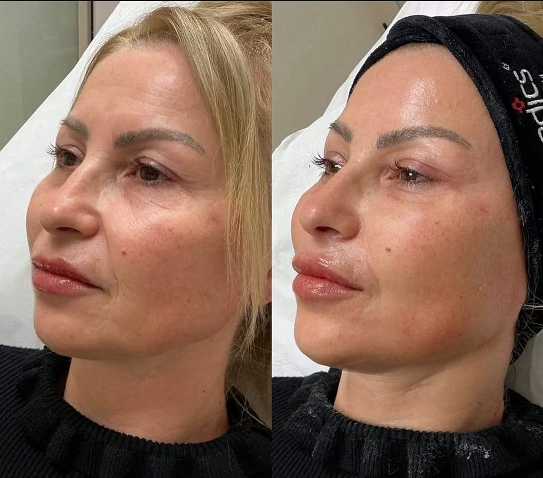 Operațiile estetice pe care le are mama ispitei Gabriella de la Insula Iubirii. Cele două au o relație apropiată