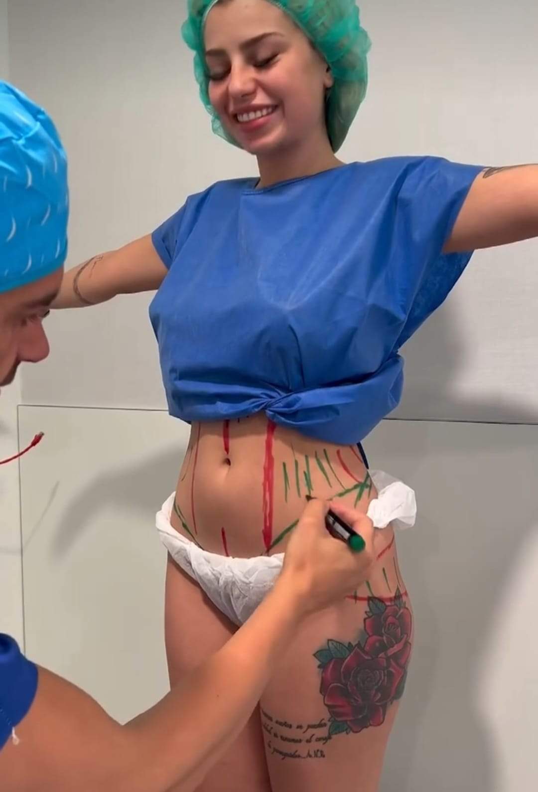 Ce operații estetice are Gabriella Barbu de la Insula Iubirii în zona feselor. Imagini cu ispita înainte de intervenție