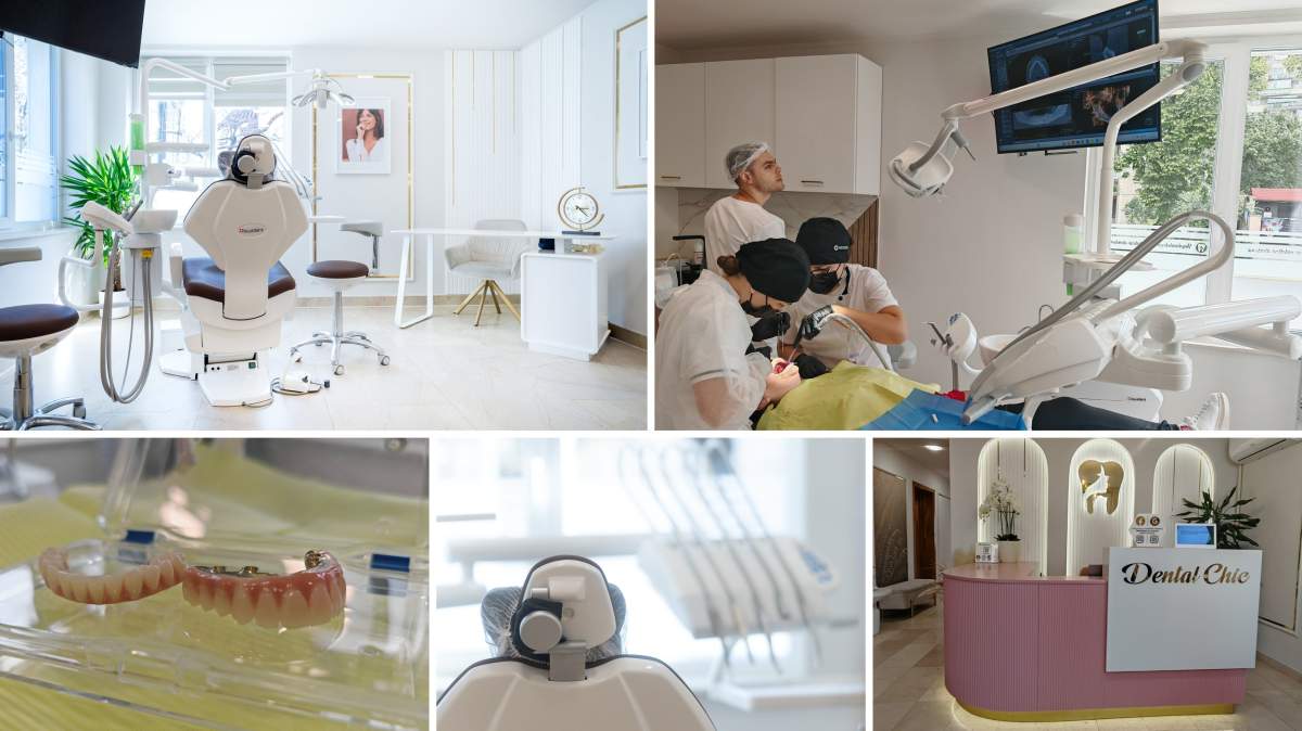 (P) Ce tipuri de coroane dentare se folosesc la Dental Chic Cluj-Napoca și cum se potrivesc fiecărui caz
