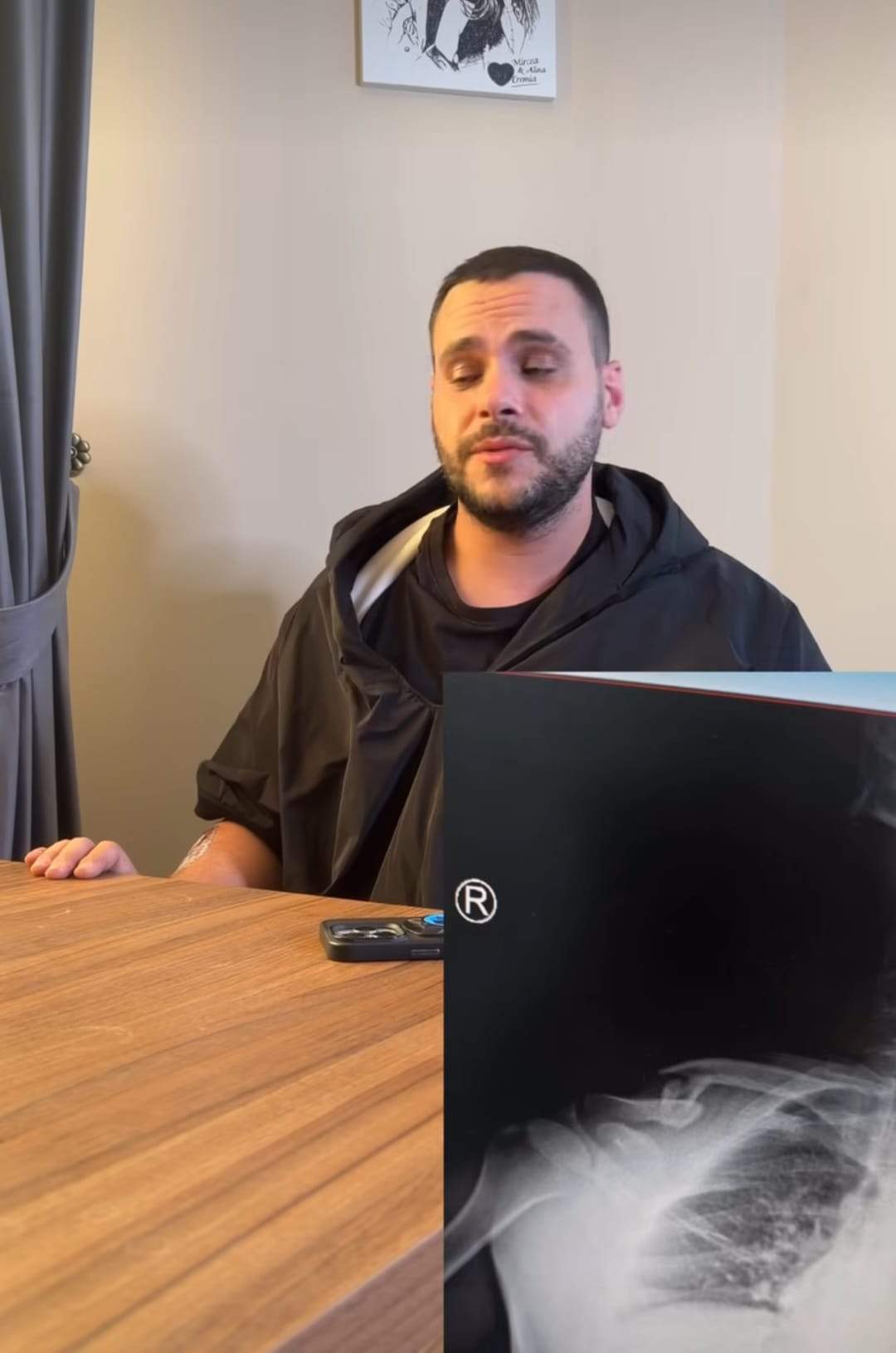 Fratele Alinei Eremia a fost implicat într-un accident! Ce decizie a luat Mircea Eremia, după ce și-a rupt clavicula