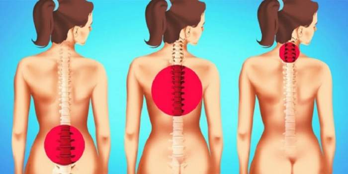 dureri de spate eficiente care este cel mai bun unguent pentru durerile de spate